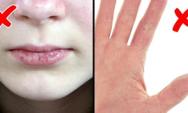 6 dấu hiệu tiết lộ bạn đang lão hóa nhanh