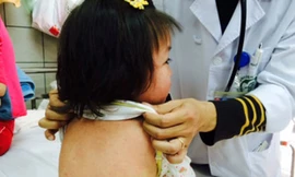 Với nhóm trẻ nhỏ, trẻ suy dinh dưỡng, sởi có thể gây những biến chứng nguy hiểm. Ảnh minh họa: H.Hải