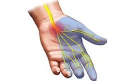 Những điều ít biết khi dùng vitamin B6