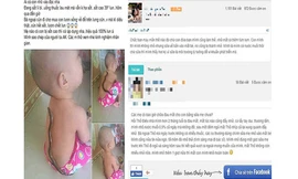 Phương pháp chữa sốt bằng lươn (trái) cho bé được một mẹ bỉm sữa chia sẻ và phương pháp chữa đau mắt bằng sữa mẹ (phải) được truyền tai, hậu quả là một phụ huynh làm theo khiến mắt bé bị nặng hơn. Ảnh: ITN