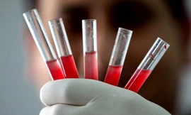 Tạo được tế bào máu và tế bào miễn dịch từ tế bào da