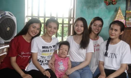 Người phụ nữ “quái thai” truyền cảm hứng sống cho thí sinh Miss World Việt Nam