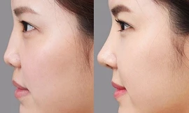 Lột xác 180 độ: Bạn có dám thử