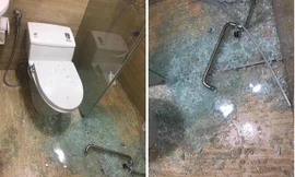 Bé trai 7 tuổi khóc thét khi kính cường lực đột nhiên phát nổ: Đâu là nguyên nhân?