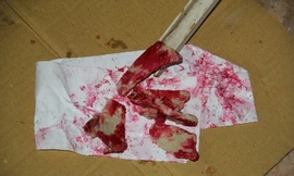 Bước đầu xác định nguyên nhân của hiện tượng thịt heo chín xuất hiện màu đỏ máu là do nấm hoặc vi khuẩn gây ra