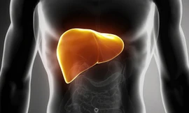 Chữa gan nhiễm mỡ bằng thực phẩm