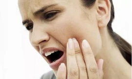 Viêm nha chu là giai đoạn nặng của bệnh viêm lợi, thường gặp ở tuổi trung niên