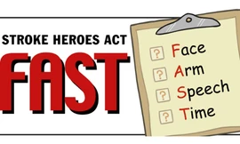 Để nhận biết các dấu hiệu tai biến mạch máu não, hãy nhớ từ FAST.