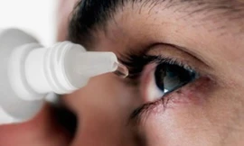 Bệnh viêm kết mạc dị ứng thường khiến người bệnh vô cùng ngứa mắt, khó chịu.