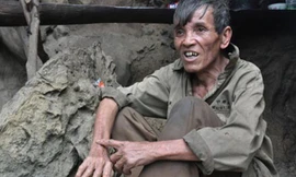 Ông Toán chỉ vào vết sẹo trong lần bị rắn cắn. 