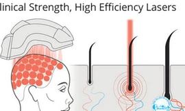 Công ty cho biết: “Người sử dụng có thể cảm thấy tóc mình sạch hơn, khỏe hơn, lượng dầu tiết ra giảm đáng kể và sẽ thấy tóc ít rụng hơn”.