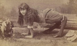 Với đôi chân dị dạng, Ella trở thành ngôi sáng của gánh xiếc. Ảnh: Wikipedia.