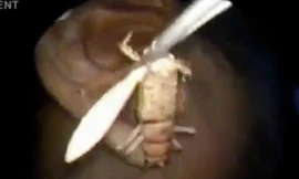 Con dế còn sống dài gần 8 cm được thận trọng lôi ra khỏi tai bệnh nhân. Ảnh: Newsrt.