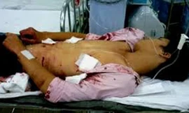 Mang họa sát thân vì tát cha dượng