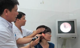 Bác sĩ khuyên không tự ý lấy ráy tai tránh làm xước da ống tai, thậm chí thủng màng nhĩ. Ảnh: N.Phương. 