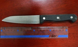 Toàn bộ lưỡi dao dài 11 cm cắm sâu vào đầu bà Liu sau cú ngã. Ảnh: Rex