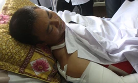  Lái xe Phan Đình Ninh đang điều trị tại bệnh viện 