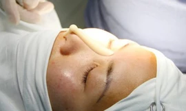 Những loại phẫu thuật thẩm mỹ dễ gây nghiện