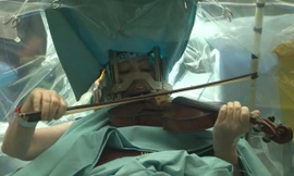 Bệnh nhân chơi đàn trong lúc bác sĩ mổ não