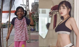 Nàng 'vịt hóa thiên nga' đang gây sốt mạng phủ nhận can thiệp dao kéo