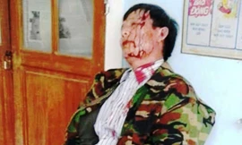 Ông Nguyên mặt đầy máu me thời điểm giằng co với Trưởng công an xã Phong Xuân. 