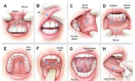 8 bước khám khoang miệng để phát hiện sớm ung thư.