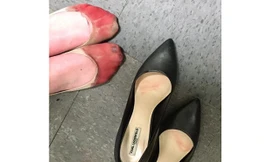 Một người bạn chụp ảnh đôi chân rướm máu của cựu nhân viên nhà hàng Joey đăng lên Facebook tuần trước. Ảnh: Facebook