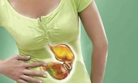 Dấu hiệu cảnh báo bạn bị ung thư dạ dày