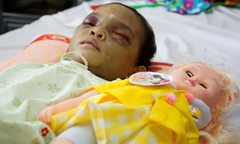 Việc giao bé gái chịu nhiều thiệt thòi này cho ai nuôi dưỡng sẽ được cơ quan chức năng cân nhắc, xem xét kỹ. 