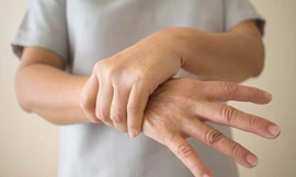 Thiết bị kích thích thần kinh không xâm lấn làm giảm run tay gần 90%