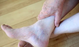 Các dấu hiệu ở chân chứng tỏ bệnh tim mạch