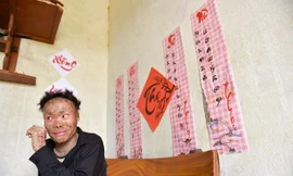 Cuộc sống lạc quan của 9x mắc bệnh 'người cá' hiếm gặp ở Hà Nội