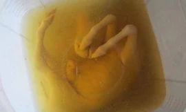 Bình rượu ngâm bào thai ngựa của ông Trí.