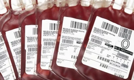 Các kháng nguyên quyết định một người thuộc nhóm máu nào. Ảnh: Wisegeekhealth.