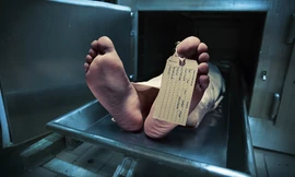 Ảnh: Medicalnewstoday