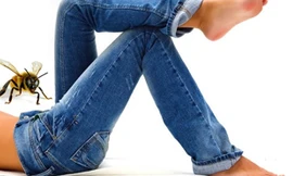 Cho ong chích vào "của quý" để nghiên cứu khoa học - Ảnh minh họa: citr 