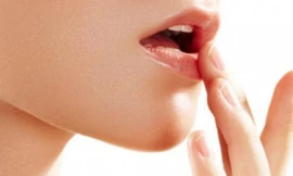 Trị môi khô nứt nẻ do ngôi máy lạnh nhiều