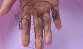 Ảnh minh họa: Internet