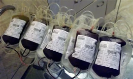 Nhóm nghiên cứu đồng thời nhận thấy cơ của chuột già được tiếp nhận máu chuột trẻ cũng khỏe mạnh hơn.