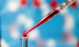 Ảnh minh hoạ: Internet