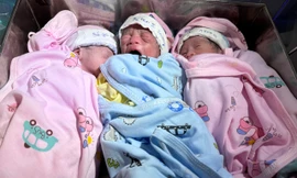 Sản phụ 40 tuổi mang thai hiếm gặp 100.000 ca mới có 1 ca