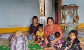 Cha tử vong, con trai 5 tuổi nhập viện nghi ngộ độc thịt cóc