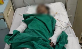 Điều tra nguyên nhân vụ cháy khiến 3 người cùng gia đình bị bỏng nặng 