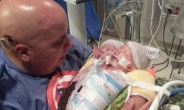 Michael Hamby, bố của cặp song sinh liền thân, bế con tại bệnh viện. Ảnh:CNN.