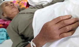 Cụ Điềm bị rắn lục đuôi đỏ cắn đang nằm điều trị tại Bệnh viện đa khoa Tây Hòa. Ảnh: Ngọc Thắng.