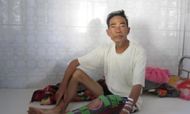 Heo rừng nặng hơn một tạ cắn nát chân người dân