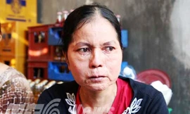 "Cô gái hóa bà già"-Ngọc Mai ở Hội An già hơn trước rất nhiều. 