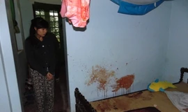 Bí ẩn vụ hành hung thiếu nữ đến nguy kịch