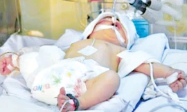 Sự sống diệu kỳ của hai đứa trẻ