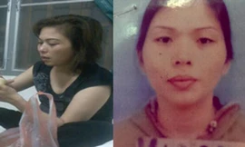 Chân dung Nguyễn Thị Thảo trước và sau khi phẫu thuật thẩm mỹ. Ảnh: Công An Nhâ​n Dân.